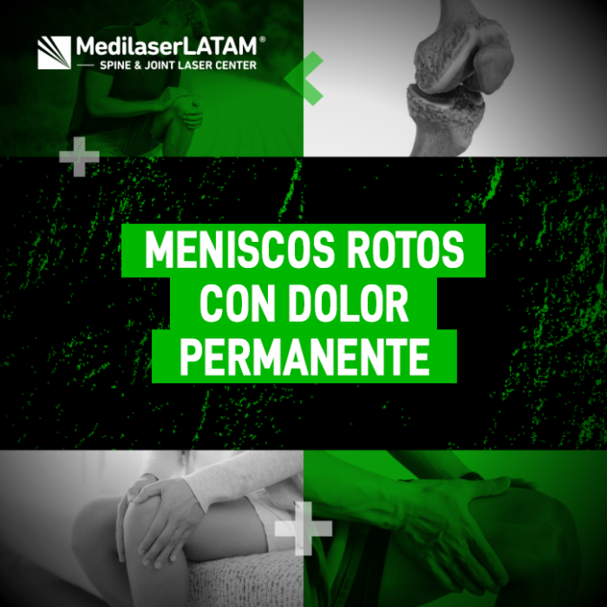 Descubre cómo tratar los Meniscos rotos y el dolor permanente con tecnología láser. Información clave para recuperar la movilidad sin cortes.