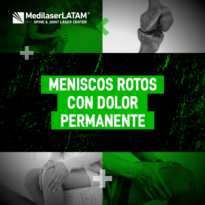 Descubre cómo tratar los Meniscos rotos y el dolor permanente con tecnología láser. Información clave para recuperar la movilidad sin cortes.