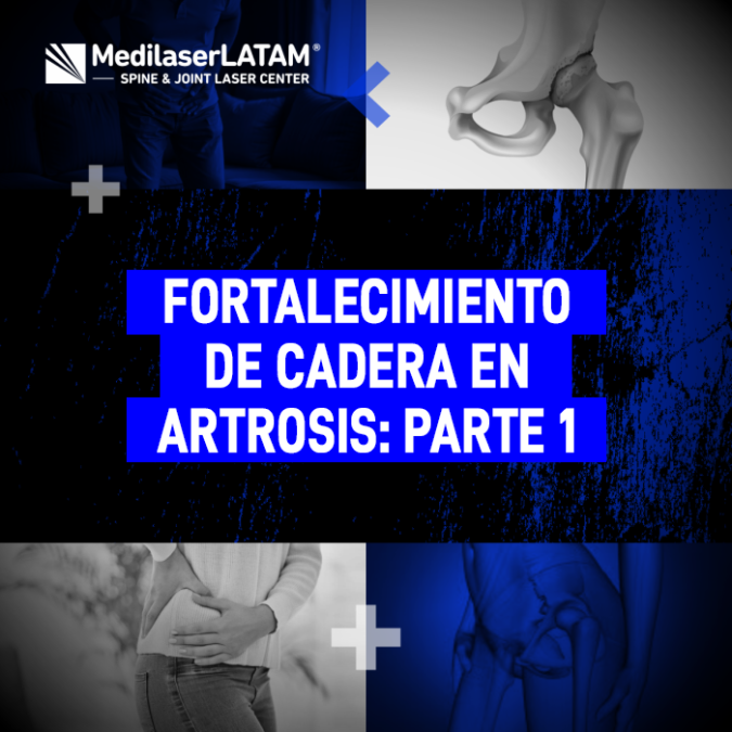 Guía de ejercicios para el fortalecimiento de cadera en casos de artrosis. Mejora tu movilidad y protege la articulación con estos consejos médicos.