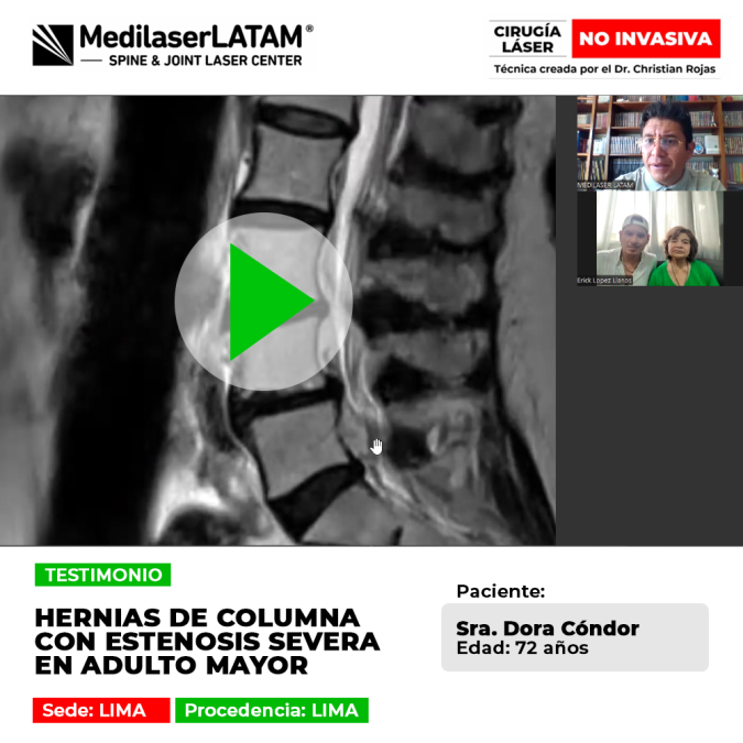 Adulto mayor supera la Estenosis de columna y Hernias con cirugía láser no invasiva. Recupera tu calidad de vida sin cortes ni riesgos.