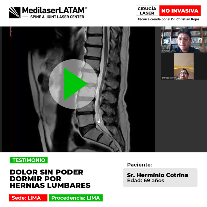 Paciente logra recuperar el sueño y aliviar el dolor tras tratamiento para Hernias lumbares. Conoce su historia de éxito con tecnología láser.