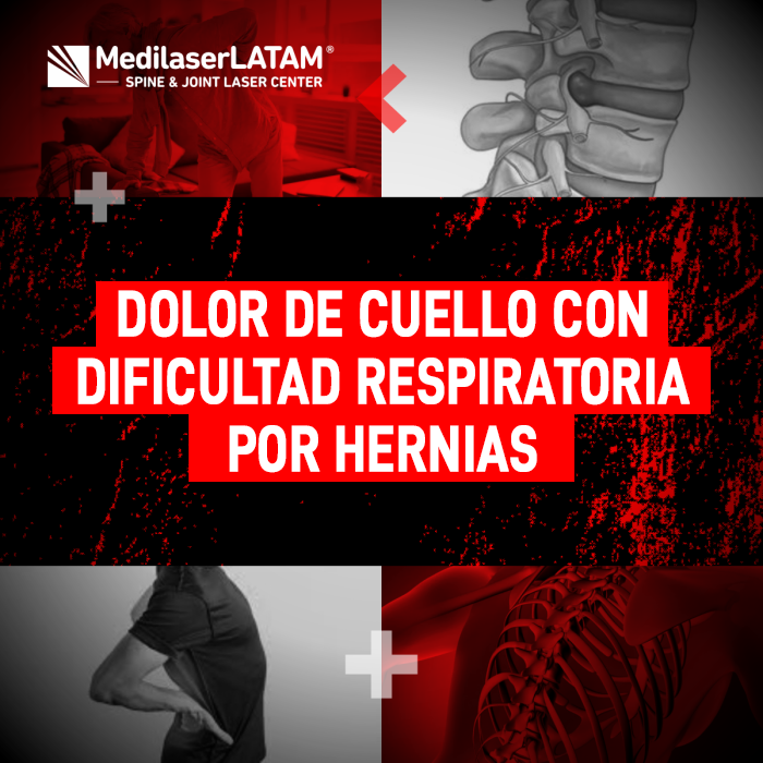 Hernias cervicales y dificultad respiratoria: cómo el dolor de cuello puede estar vinculado a problemas de columna que afectan tus pulmones.