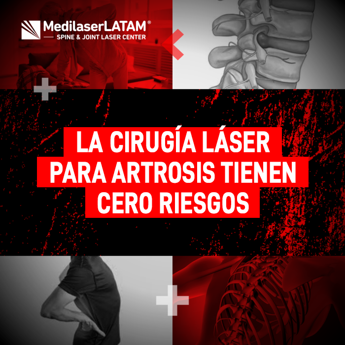Cirugía láser para Artrosis: descubre por qué este procedimiento de alta precisión ofrece máxima seguridad y cero riesgos para el paciente.