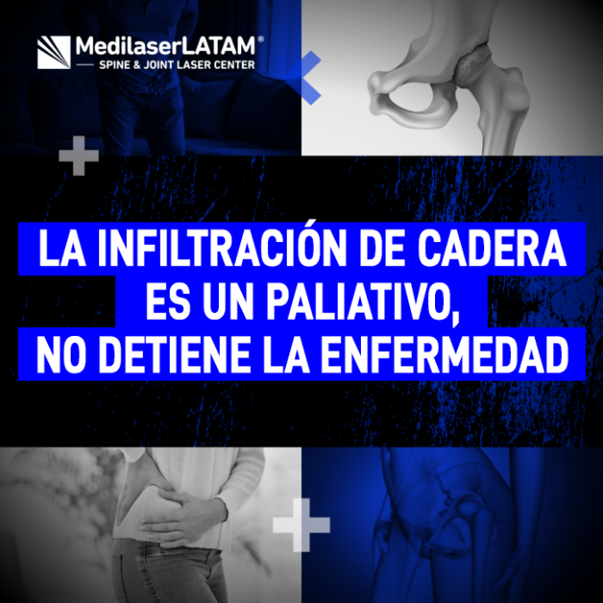 Infiltración de cadera es un paliativo. Descubre por qué este procedimiento no detiene la enfermedad con la explicación del Dr. Rojas.