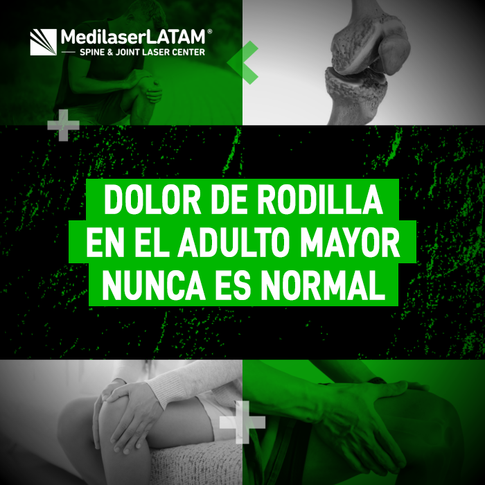 Dolor de rodilla en el adulto mayor: por qué no debe aceptarse como parte de la edad y cómo la cirugía láser detiene el desgaste.