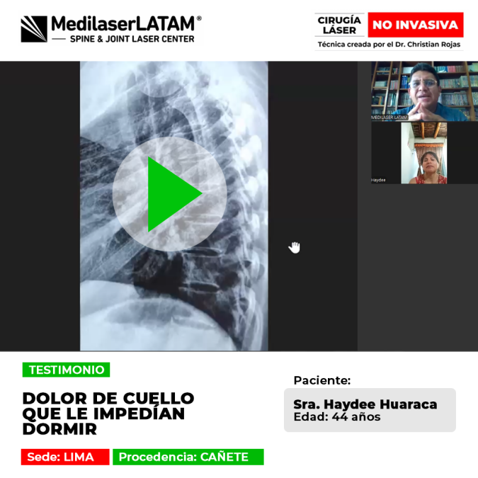 Análisis del dolor de cuello severo y su relación con trastornos del sueño, junto con alternativas de recuperación mediante tecnología láser.