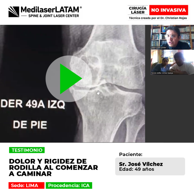 Dolor y rigidez de rodilla al comenzar a caminar: testimonio de recuperación de un paciente de Ica mediante tratamiento láser sin cirugía.