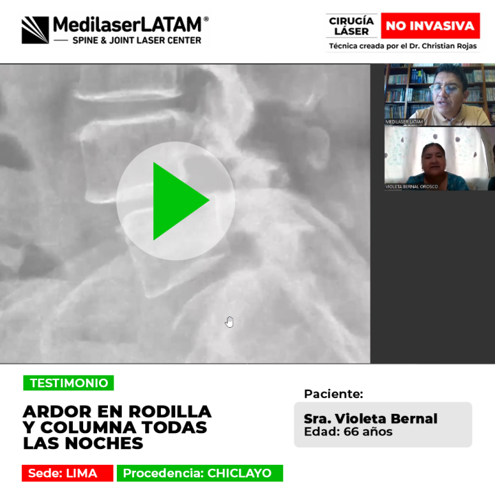 Ardor en rodilla y columna: cómo la tecnología láser de alta potencia elimina el dolor nocturno y restaura el descanso profundo.