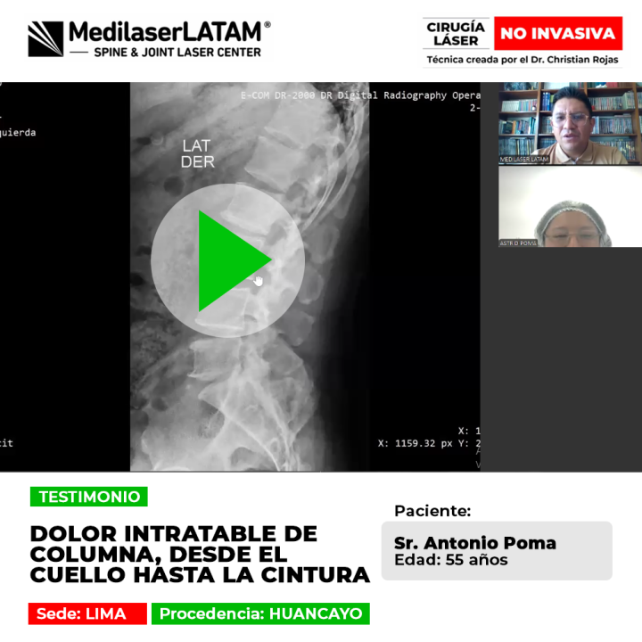 Dolor intratable de columna desde el cuello a la cintura. Mira cómo el tratamiento láser médico logra aliviar estas dolencias crónicas.