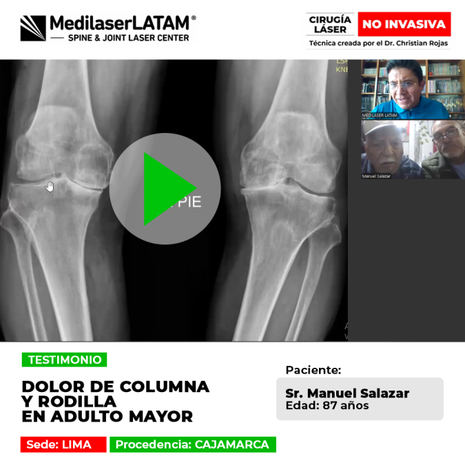 Dolor de columna y rodilla en el adulto mayor. Descubre la recuperación de este paciente con tecnología láser avanzada en nuestro blog.