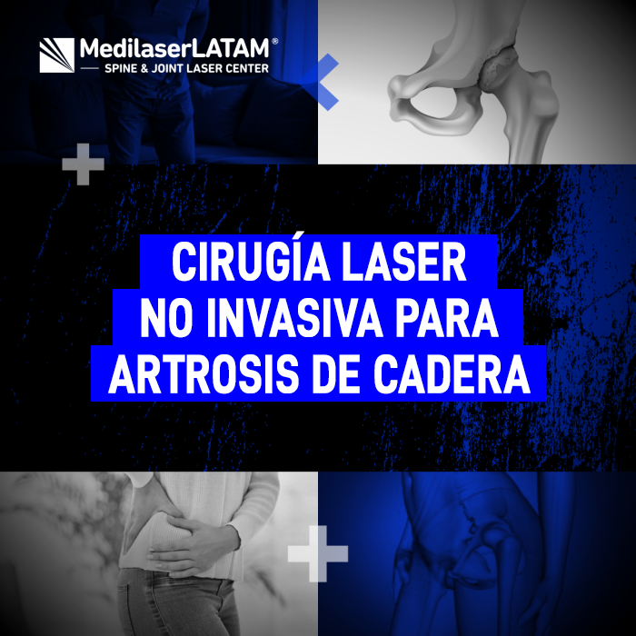Cirugía láser no invasiva para Artrosis de cadera. Descubre cómo esta tecnología médica ayuda a recuperar la movilidad y reducir el dolor.