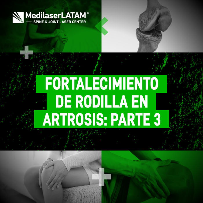 Fortalecimiento de rodilla en Artrosis: parte 3. El Dr. Christian Rojas comparte ejercicios y consejos clave para pacientes con desgaste articular.