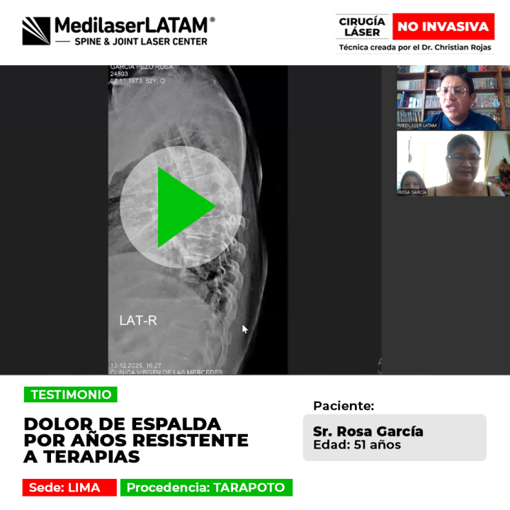 Dolor de espalda por años resistente a terapias. Descubre la recuperación de este paciente con tecnología láser avanzada en nuestro blog.