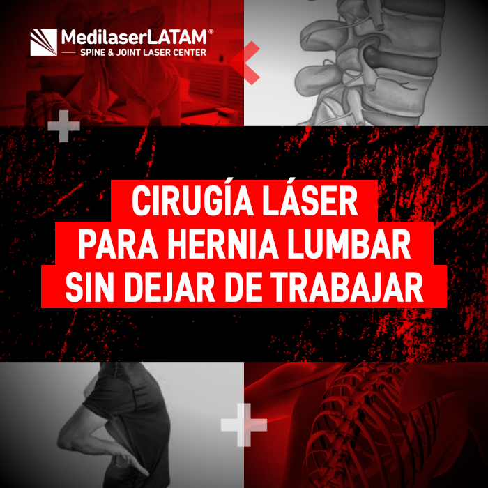 ¿Hernia lumbar? Conoce el procedimiento láser ambulatorio que permite eliminar el dolor y retomar tus labores sin reposos prolongados.