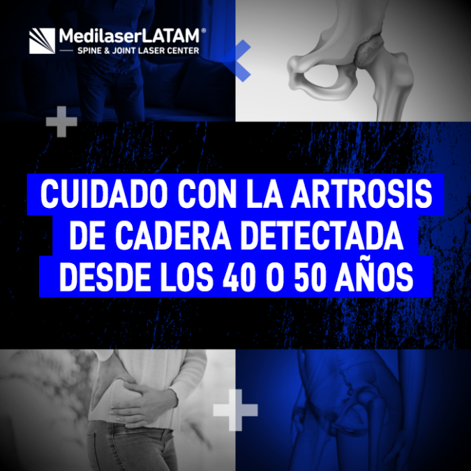 Infórmate sobre cómo abordar la artrosis de cadera a temprana edad y qué medidas tomar para frenar a tiempo el daño articular.