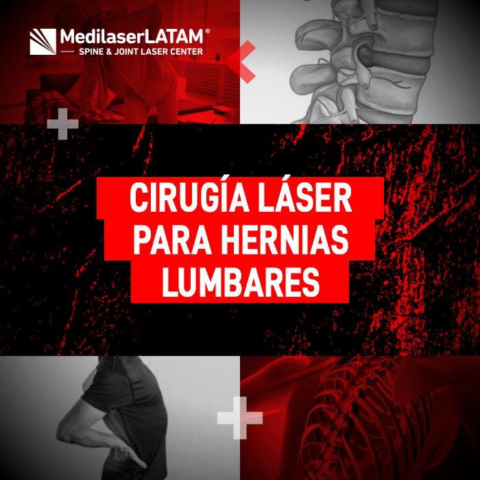 La cirugía láser hernias es un tratamiento avanzado. Infórmate sobre su efectividad y beneficios médicos.