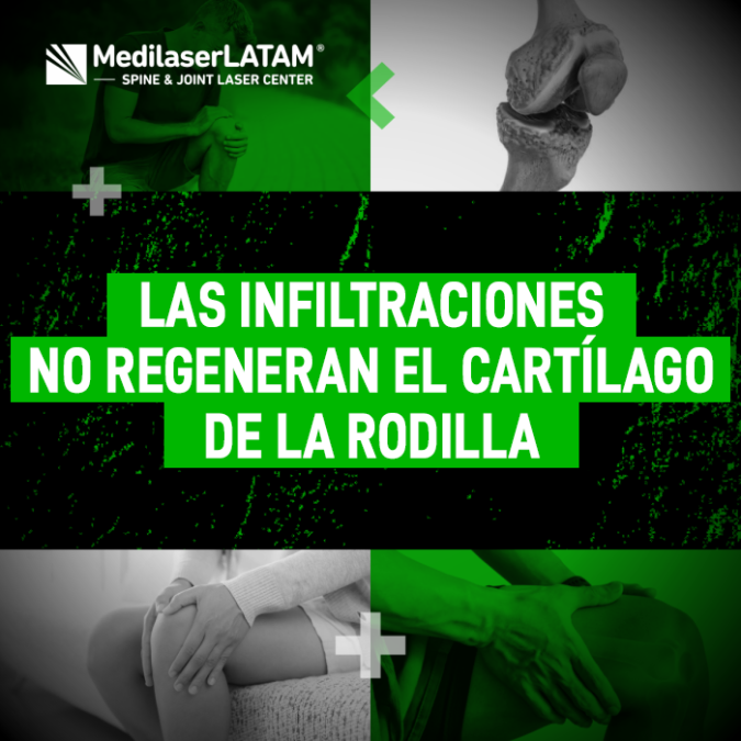 Las infiltraciones cartílago rodilla no reparan el desgaste articular. Infórmate sobre alternativas terapéuticas efectivas.