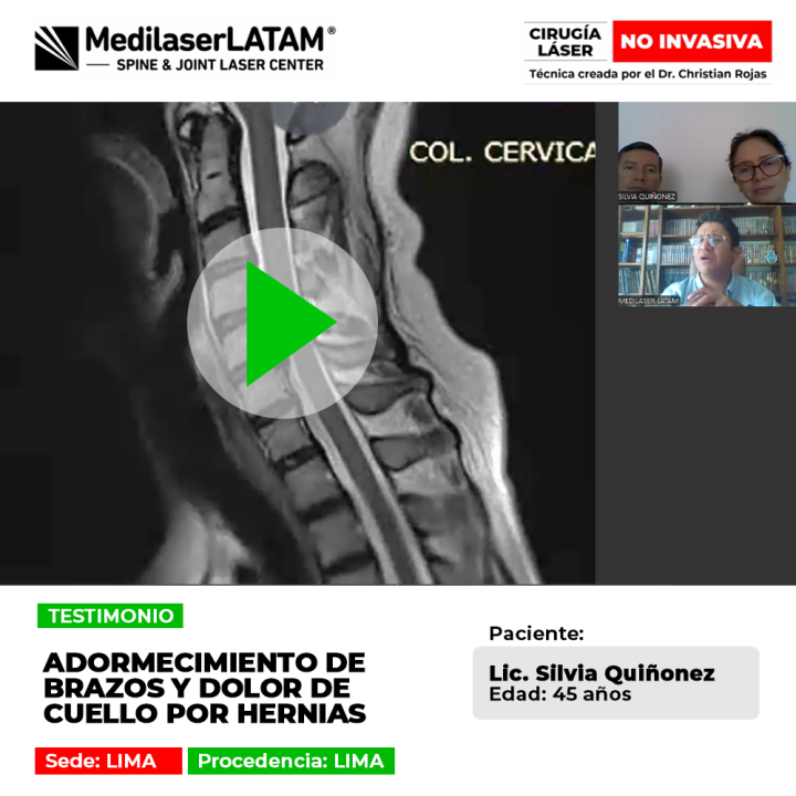 El adormecimiento de brazos y dolor cervical aquejaban a esta paciente en Lima. Descubre la solución médica que devolvió su salud.