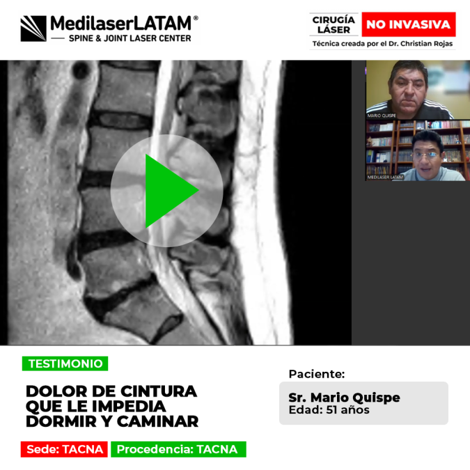 El dolor de cintura severo e invalidante puede impedir el descanso y la movilidad. Conoce este caso de recuperación efectiva.