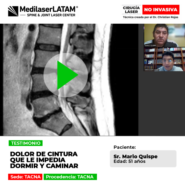 El dolor de cintura severo e invalidante puede impedir el descanso y la movilidad. Conoce este caso de recuperación efectiva.