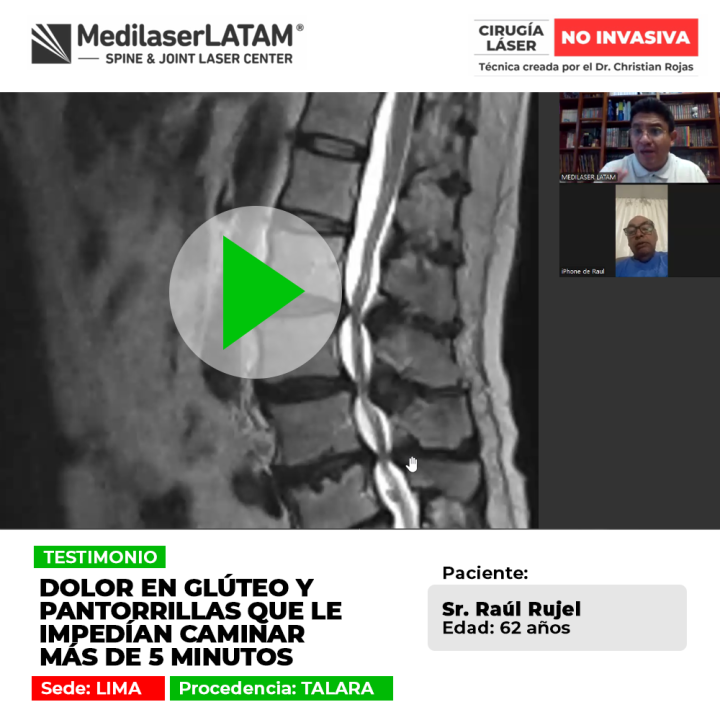 Dolor en glúteo: conoce las causas de esta molestia al caminar y las opciones de tratamiento para recuperar la movilidad.
