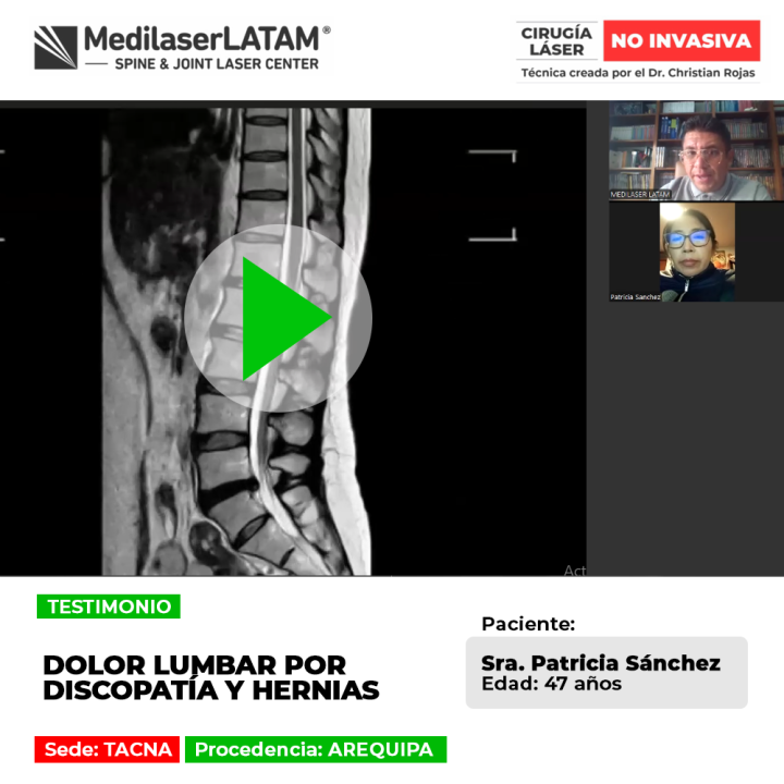 Discopatía y hernias: descubre cómo afectan la zona lumbar y los procedimientos médicos disponibles para aliviar el dolor.