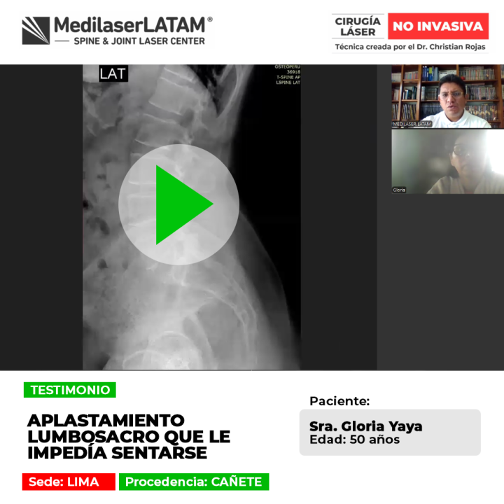 El aplastamiento lumbosacro causa dolores intensos e imposibilita sentarse. Conoce cómo recuperar la movilidad con este tratamiento.