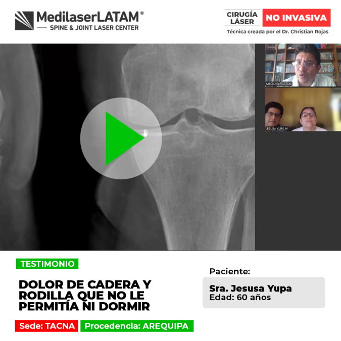 El dolor de cadera y articulaciones puede alterar el descanso nocturno. Descubre alternativas médicas para superar estas molestias.
