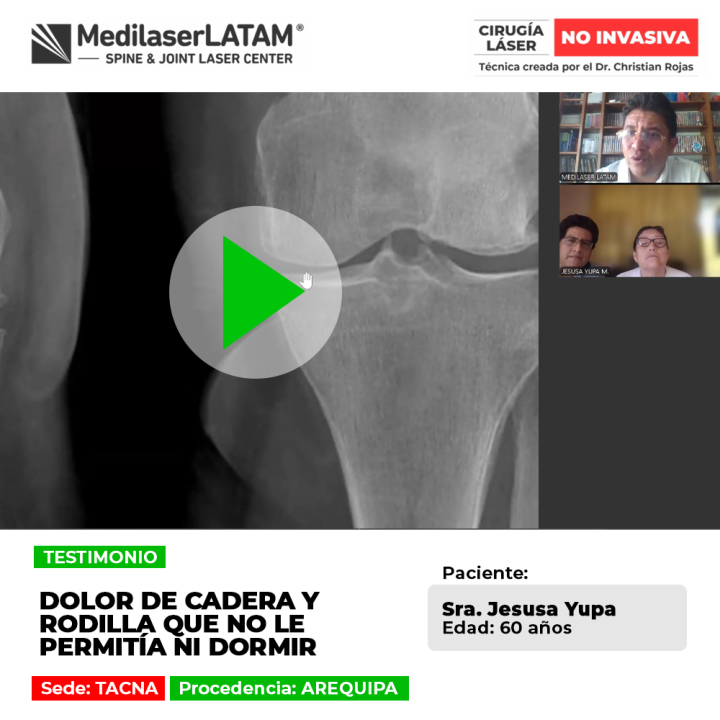El dolor de cadera y articulaciones puede alterar el descanso nocturno. Descubre alternativas médicas para superar estas molestias.