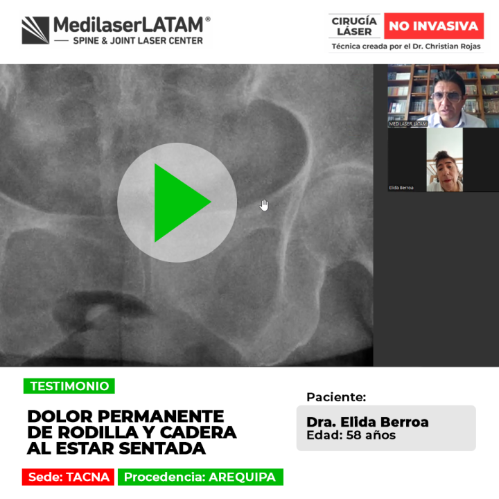 El dolor permanente rodilla y cadera dificulta permanecer en reposo. Infórmate sobre opciones efectivas para aliviar los síntomas.