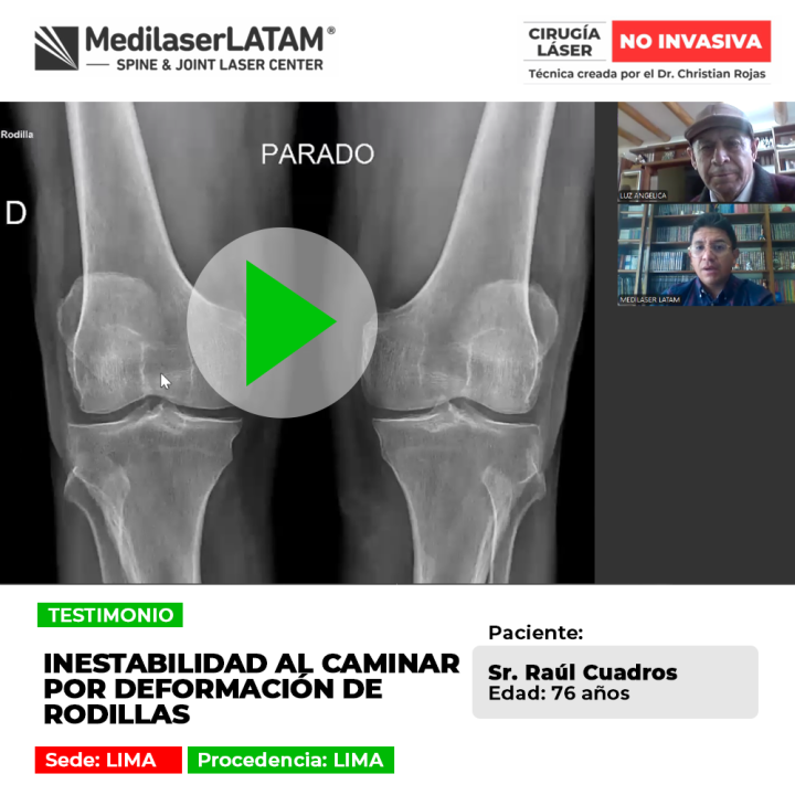 La deformación de rodillas produce inestabilidad y dificultad al andar. Conoce cómo recuperar la firmeza y calidad de movimiento.
