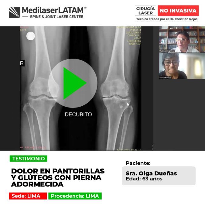 El dolor en pantorrillas y glúteos suele vincularse a compresión nerviosa lumbar. Conoce cómo aliviar el adormecimiento continuo.