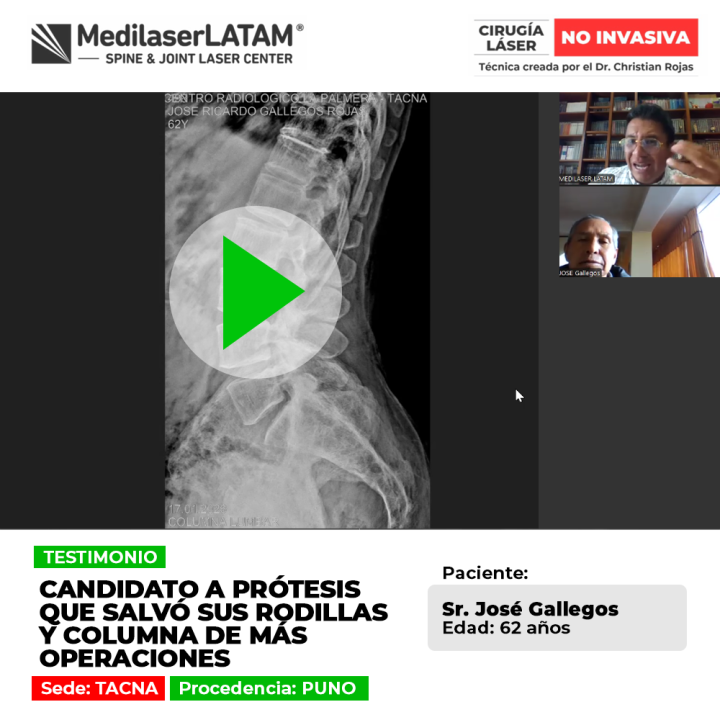 La prótesis de rodilla puede evitarse mediante tratamientos médicos avanzados. Descubre cómo proteger la columna y articulaciones.
