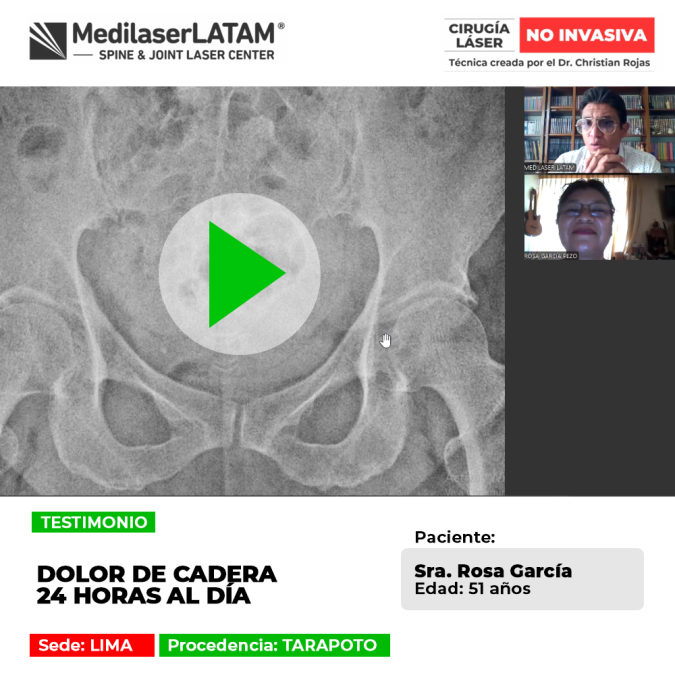 El dolor de cadera continuo desgasta la calidad de vida y el bienestar. Infórmate sobre alternativas terapéuticas para su control.