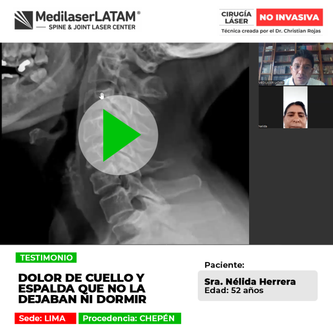 El dolor de cuello y espalda cervical impide conciliar un sueño reparador. Conoce tratamientos especializados para el alivio.