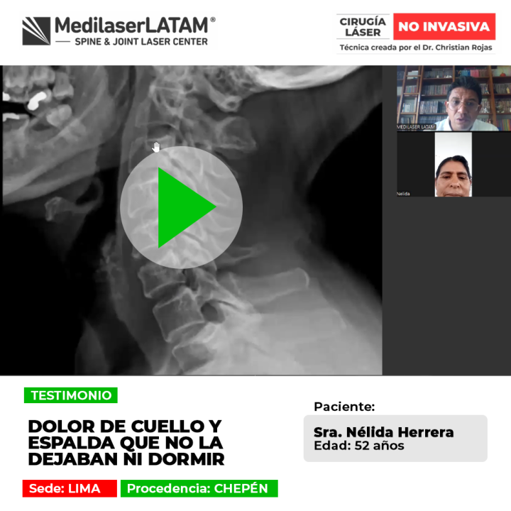 El dolor de cuello y espalda cervical impide conciliar un sueño reparador. Conoce tratamientos especializados para el alivio.