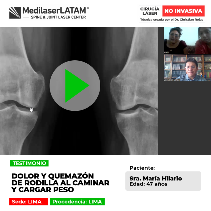 La quemazón de rodilla al caminar o levantar peso indica daño articular. Conoce las opciones médicas para recuperar la fuerza.