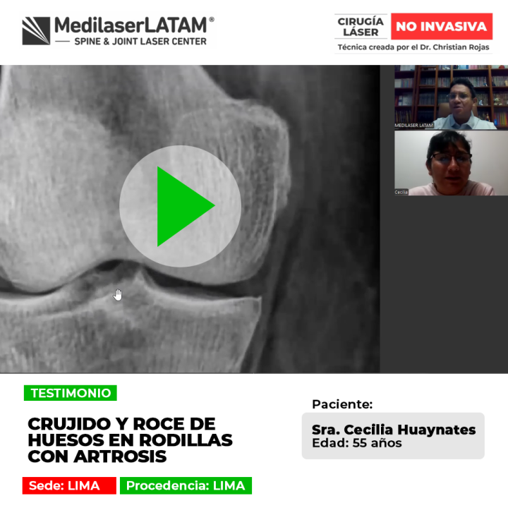 El crujido de rodillas y roce óseo advierten artrosis avanzada. Descubre tratamientos médicos para frenar el desgaste articular.