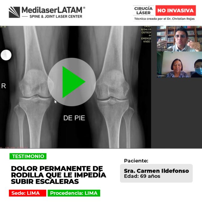 El dolor de rodilla constante complica actividades cotidianas como subir gradas. Conoce alternativas efectivas de recuperación.