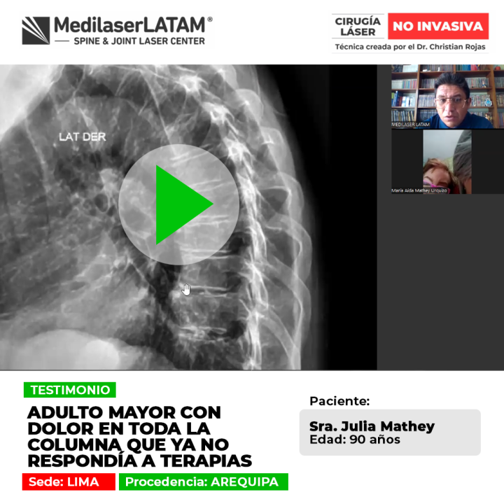 Un dolor en columna generalizado exige opciones médicas avanzadas cuando las terapias físicas no logran mejorías satisfactorias.