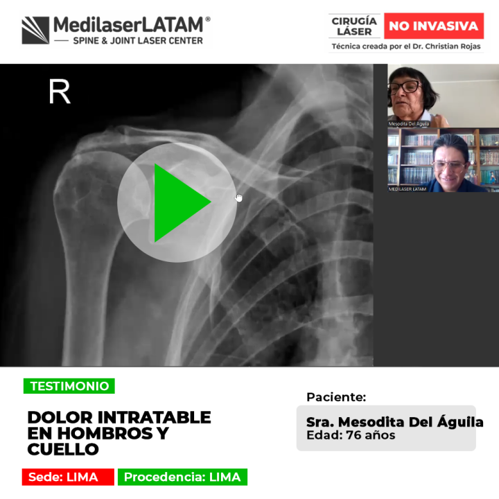 El dolor en hombros y zona cervical limita la movilidad de brazos y cuello. Descubre opciones médicas para controlar la molestia.