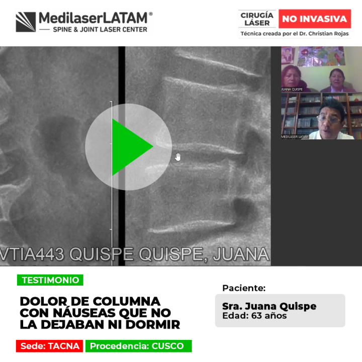 El dolor de columna severo puede generar náuseas y perturbar el sueño nocturno. Descubre soluciones médicas efectivas para descansar bien.