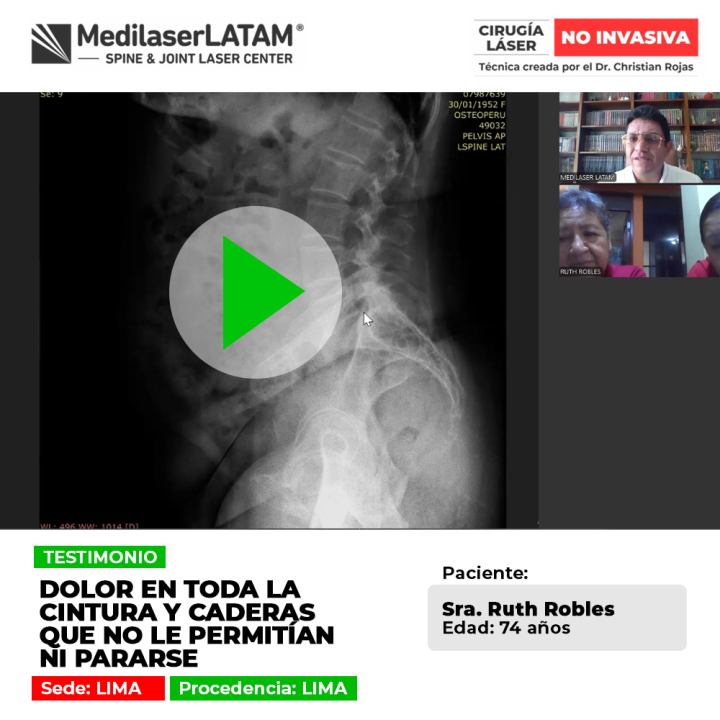El dolor de cintura y cadera severo impide mantenerse de pie con normalidad. Conoce alternativas médicas para recuperar la movilidad.