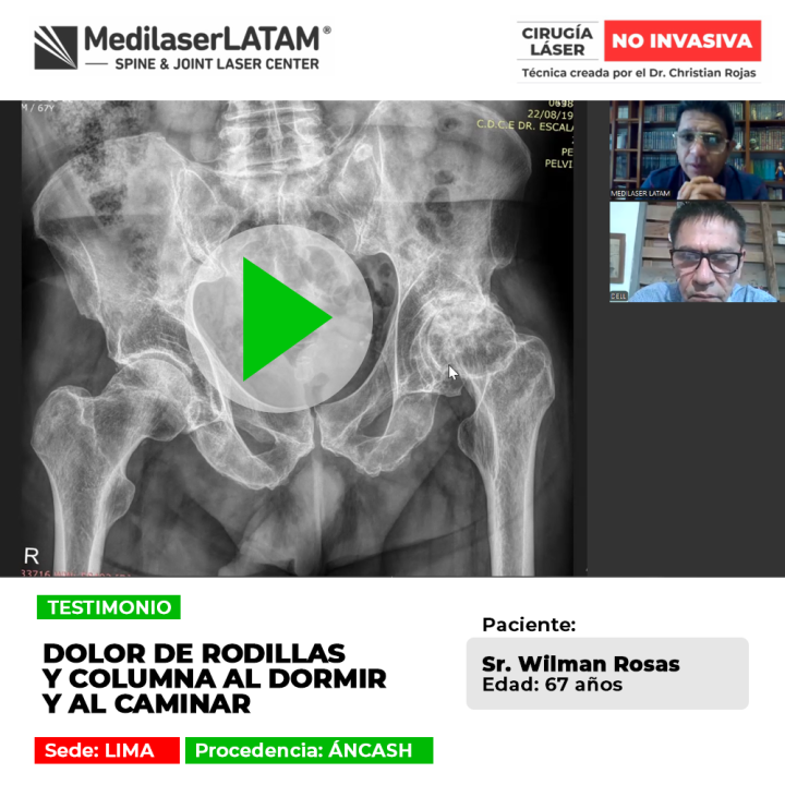 El dolor de rodillas y columna interrumpe el sueño y dificulta la marcha regular. Descubre tratamientos especializados para el alivio.