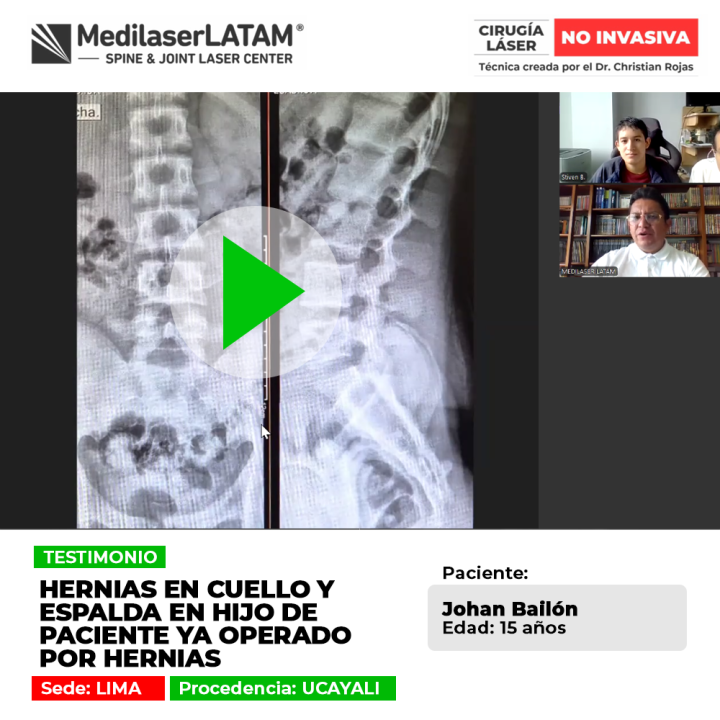 Las hernias en cuello y espalda afectan a jóvenes y adultos. Descubre cómo tratar los discos dañados y evitar operaciones complejas.