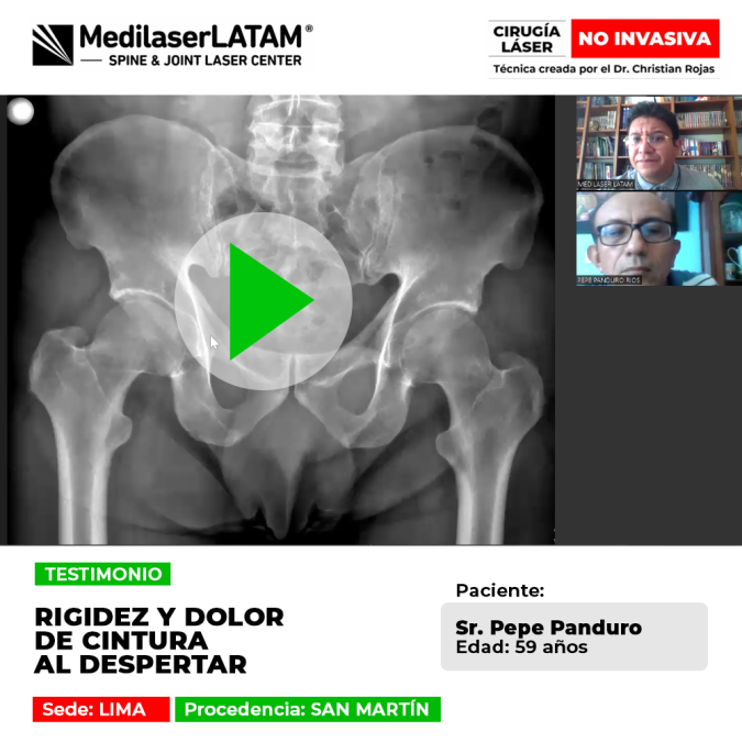 El dolor de cintura con rigidez al despertar perjudica el inicio del día. Conoce alternativas médicas oportunas para su alivio seguro.